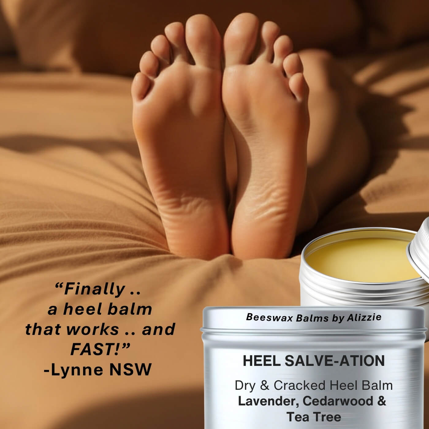 DRY CRACKED HEEL BALM - Heel Salve-ation